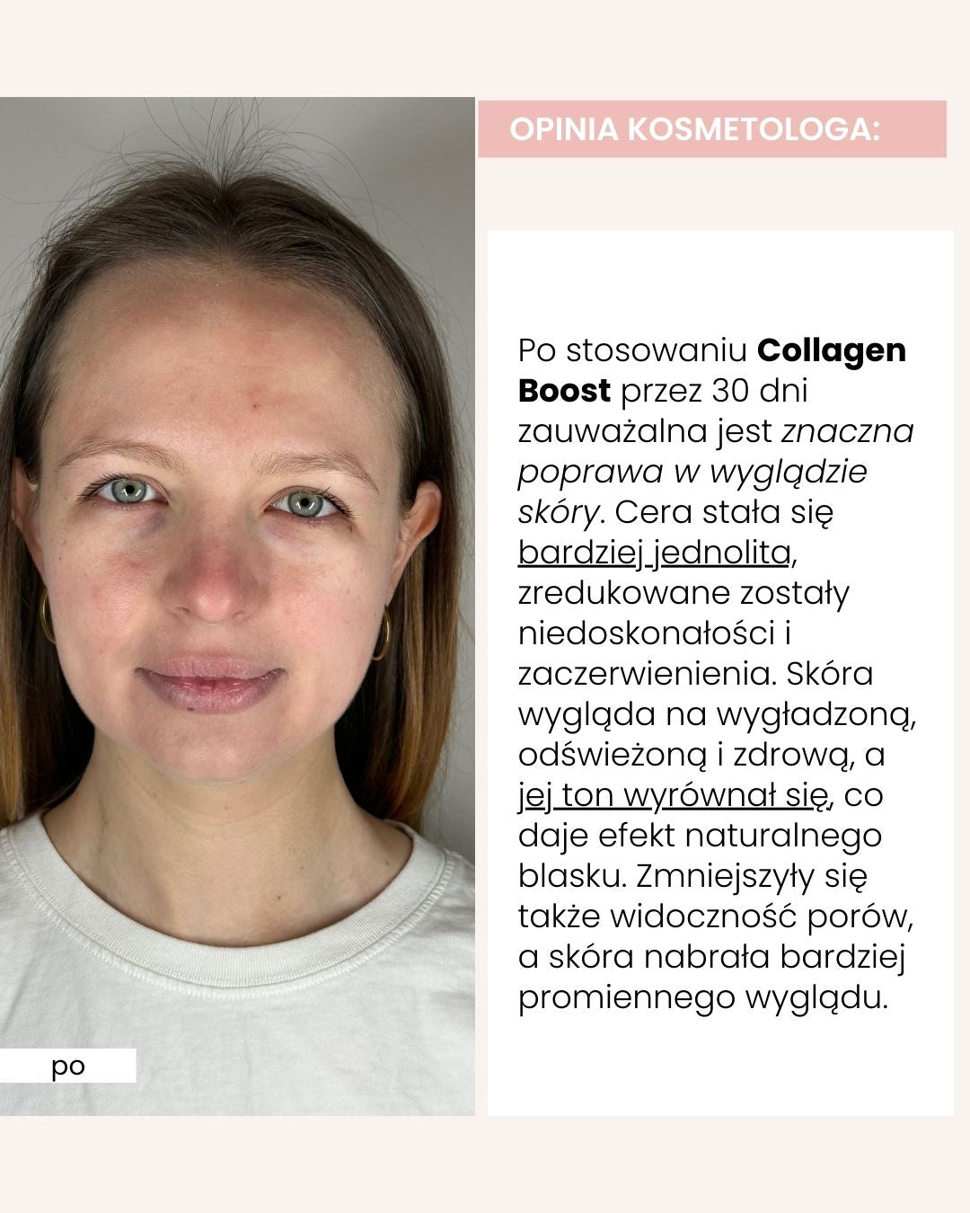Collagen Boost