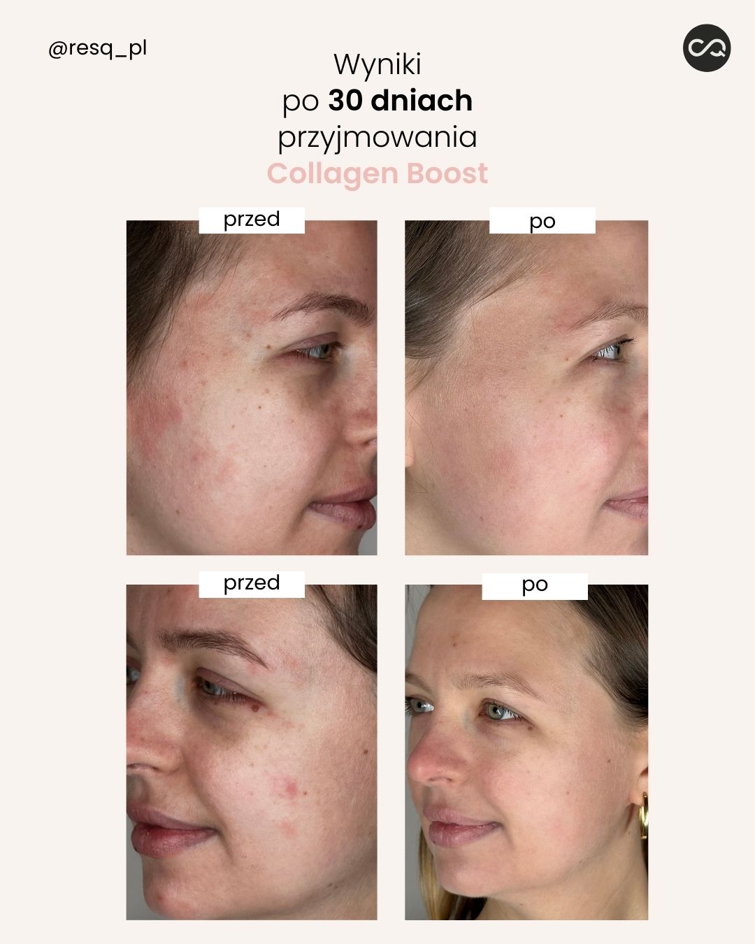 Collagen Boost