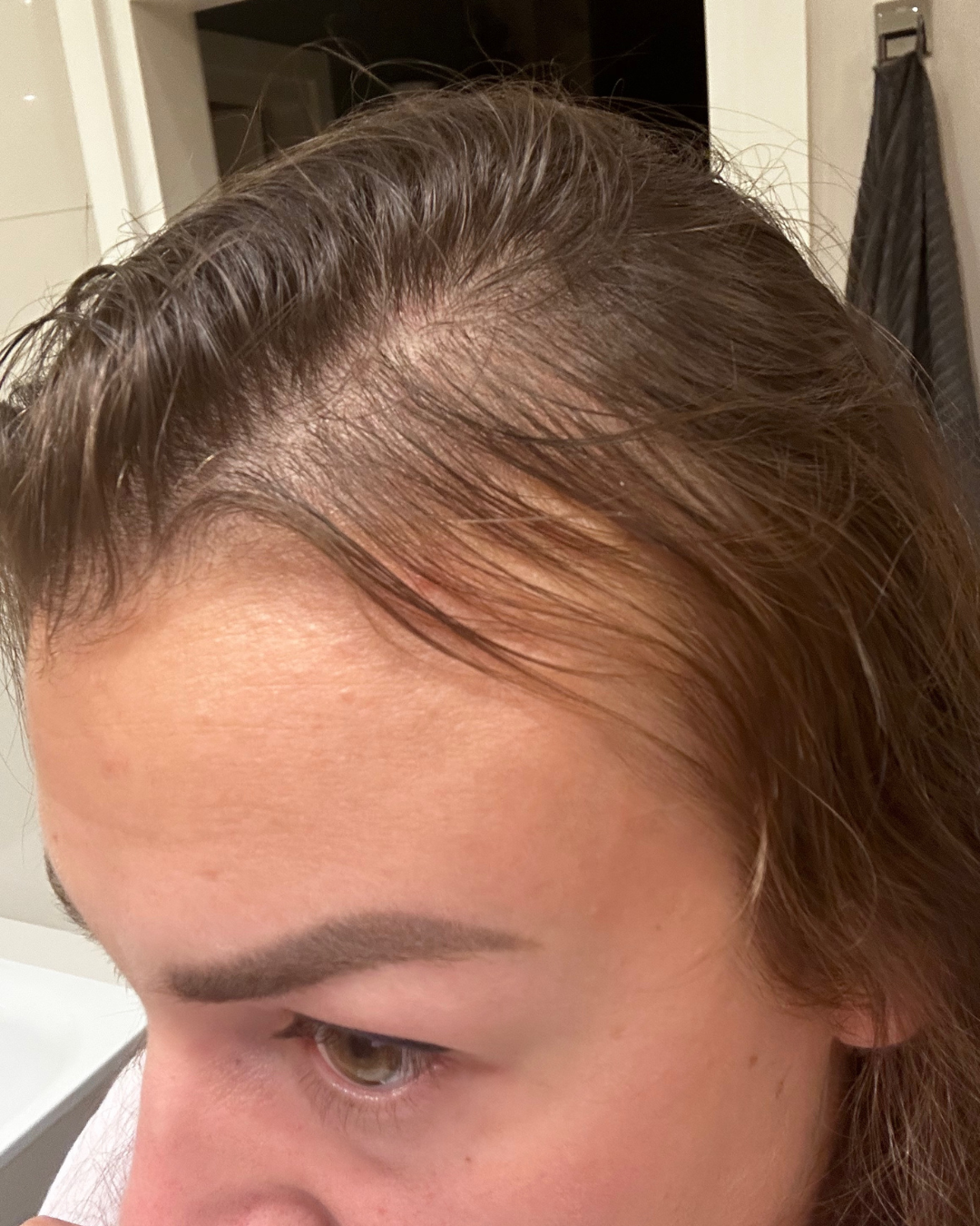 Before