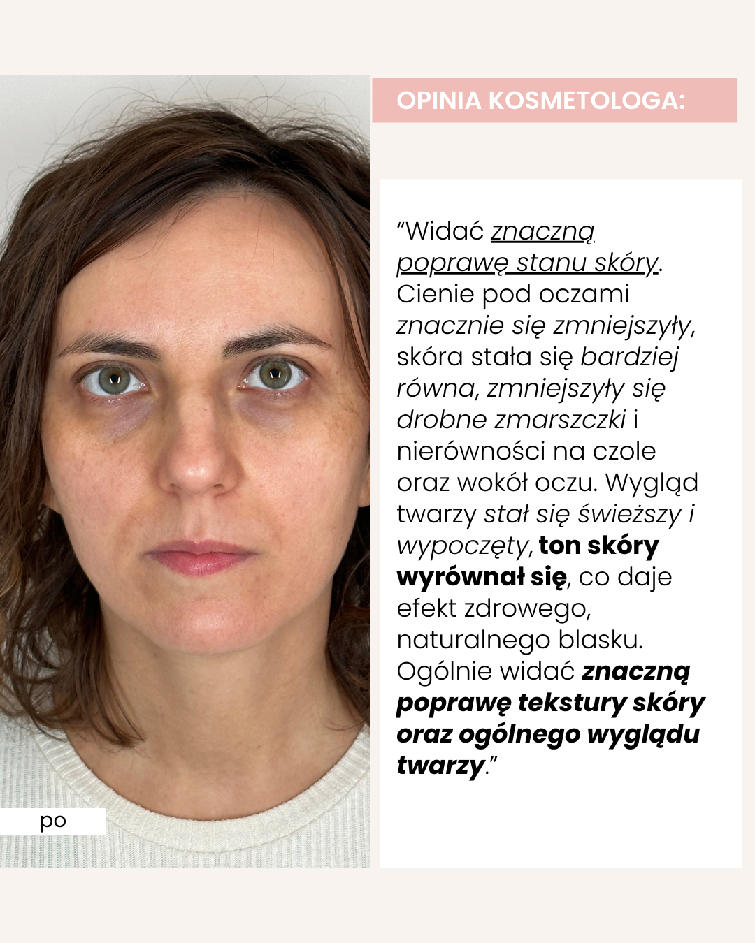 Collagen Boost